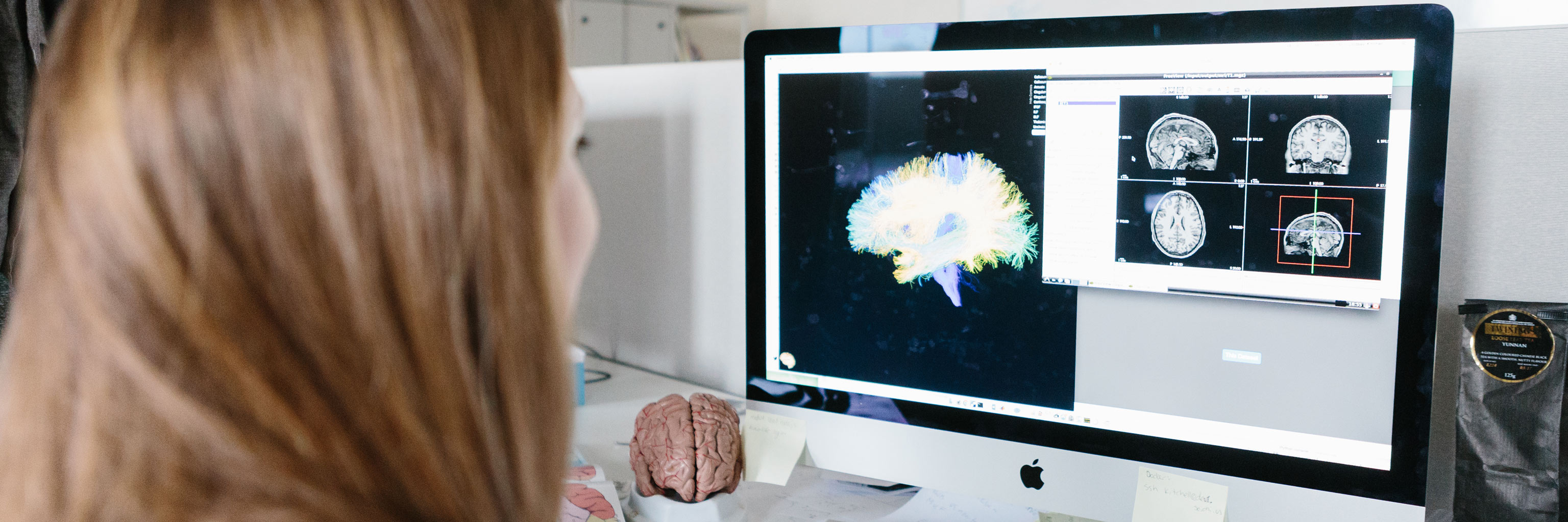 woman looking at brain scans on a computer