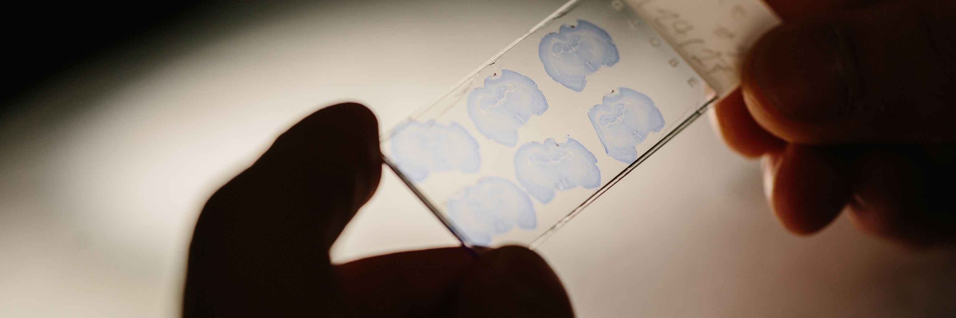 glass slide being held by hands